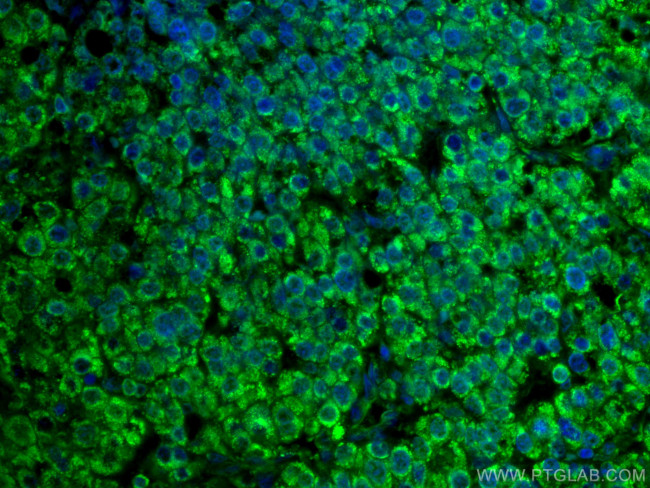 MLKL Antibody in Immunohistochemistry (PFA fixed) (IHC (PFA))