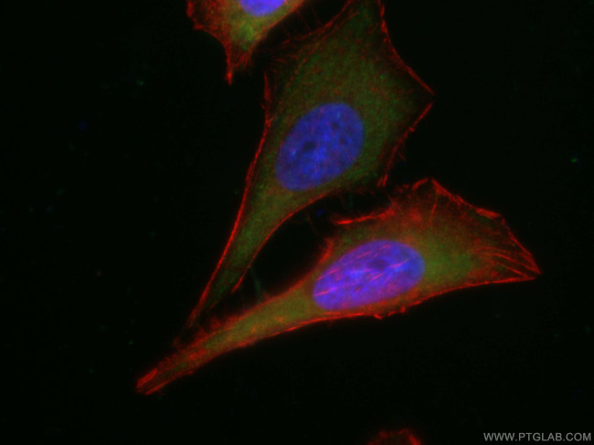 TNFAIP3 Antibody in Immunocytochemistry (ICC/IF)