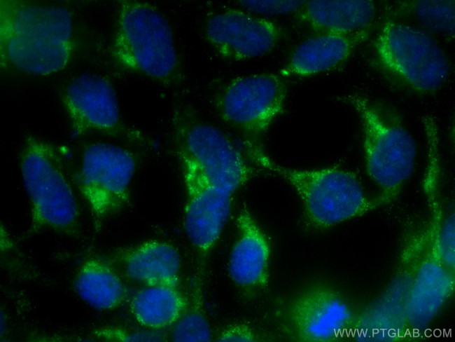 TPT1 Antibody in Immunocytochemistry (ICC/IF)