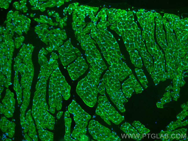 Dystroglycan Antibody in Immunohistochemistry (PFA fixed) (IHC (PFA))