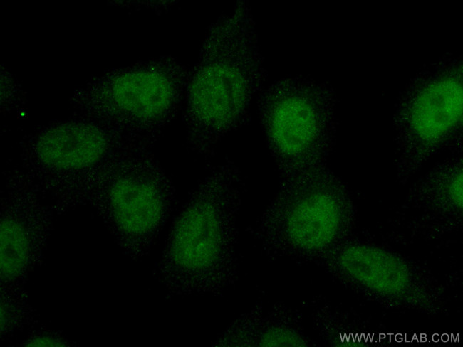 SRF Antibody in Immunocytochemistry (ICC/IF)