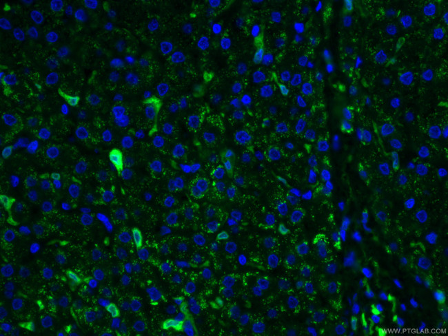 HO-1/HMOX1 Antibody in Immunohistochemistry (PFA fixed) (IHC (PFA))