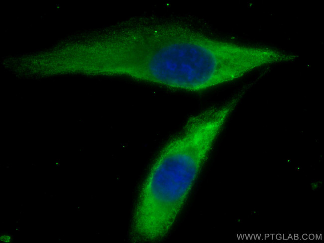 EEF1A2 Antibody in Immunocytochemistry (ICC/IF)