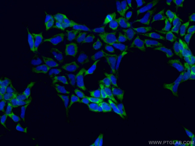 PABPC1,PABP Antibody in Immunocytochemistry (ICC/IF)