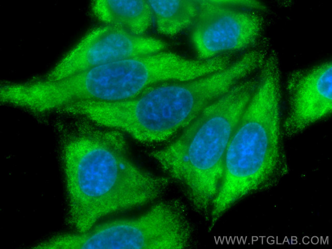 TFPI Antibody in Immunocytochemistry (ICC/IF)