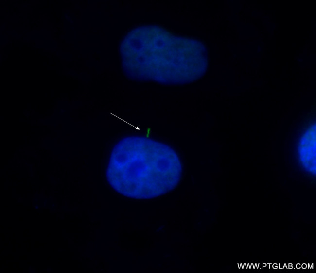 SMO Antibody in Immunocytochemistry (ICC/IF)