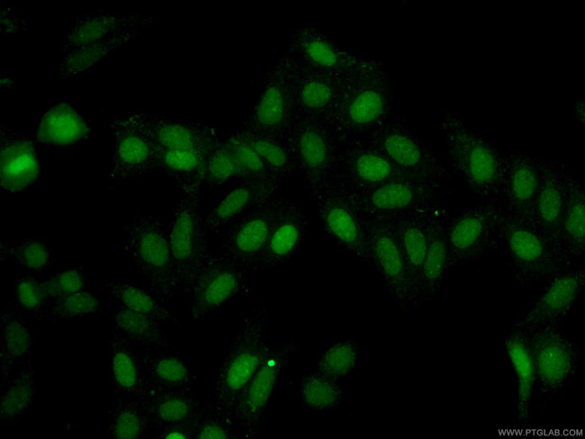 ASF1A Antibody in Immunocytochemistry (ICC/IF)