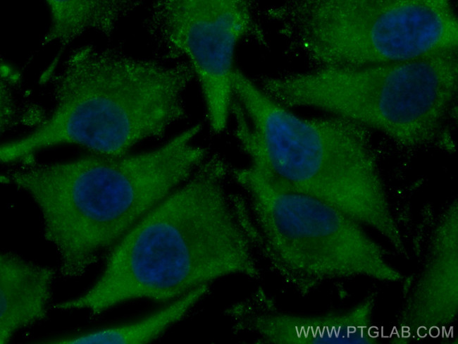 DLC1 Antibody in Immunocytochemistry (ICC/IF)