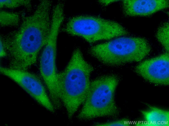 YAP1 Antibody in Immunocytochemistry (ICC/IF)