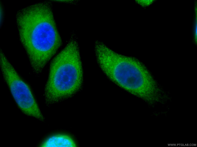 Calnexin Antibody in Immunocytochemistry (ICC/IF)