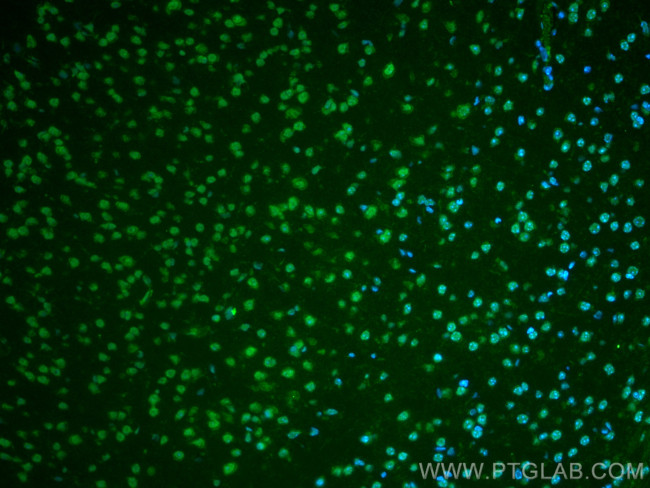 Glucocorticoid receptor Antibody in Immunohistochemistry (PFA fixed) (IHC (PFA))