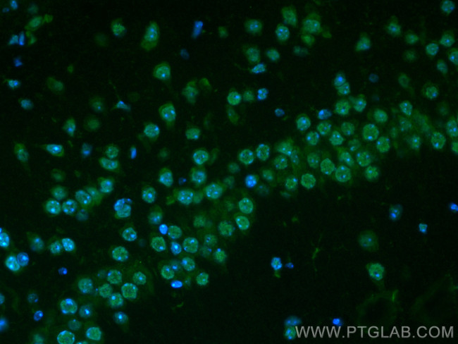 Glucocorticoid receptor Antibody in Immunohistochemistry (PFA fixed) (IHC (PFA))