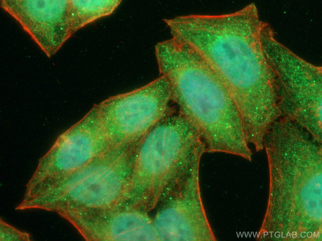 NFATC3 Antibody in Immunocytochemistry (ICC/IF)