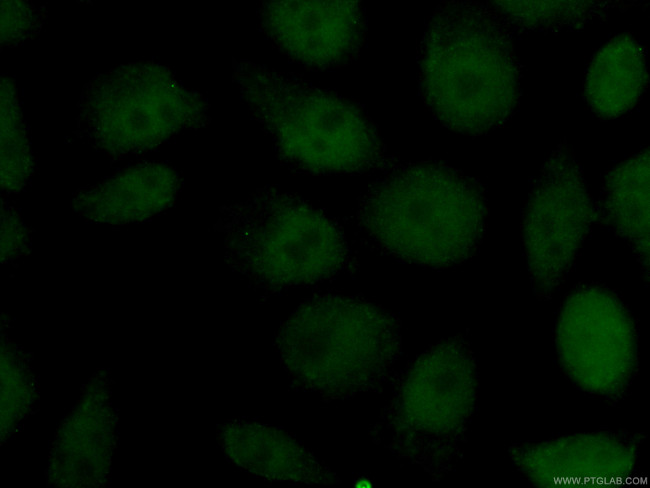 NBN Antibody in Immunocytochemistry (ICC/IF)