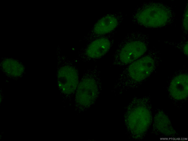 CTBP1 Antibody in Immunocytochemistry (ICC/IF)