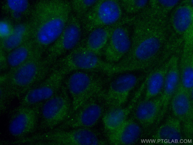 CEP63 Antibody in Immunocytochemistry (ICC/IF)