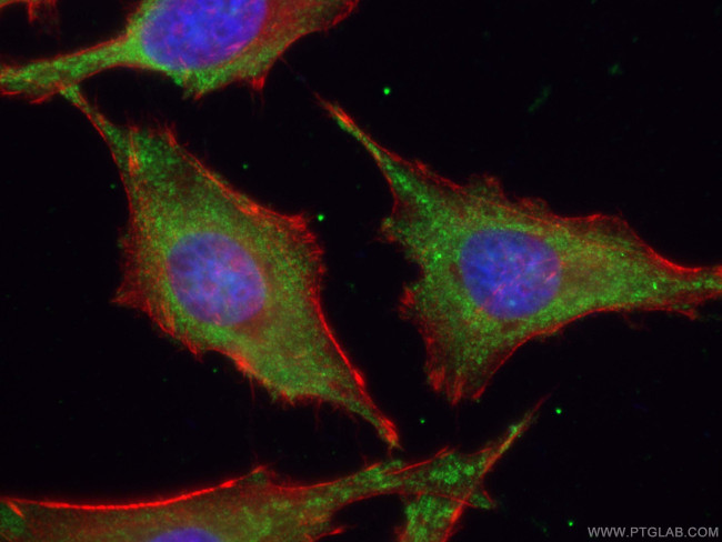 ATG9A Antibody in Immunocytochemistry (ICC/IF)