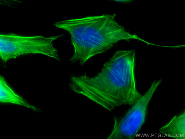 FLNA Antibody in Immunocytochemistry (ICC/IF)