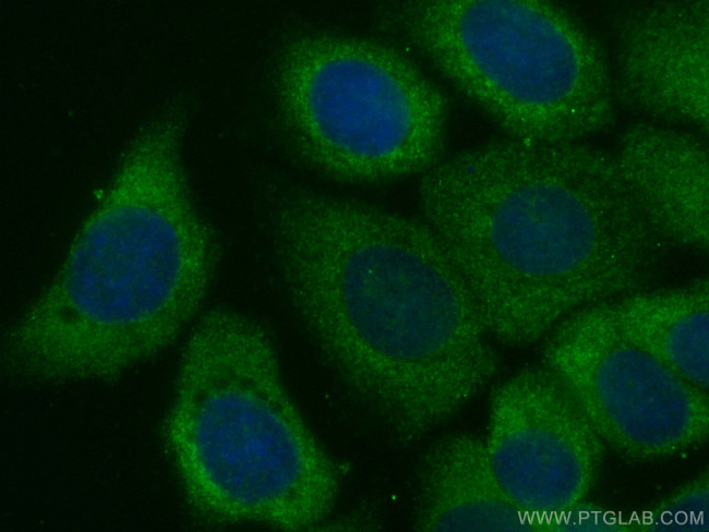 GBP1 Antibody in Immunocytochemistry (ICC/IF)