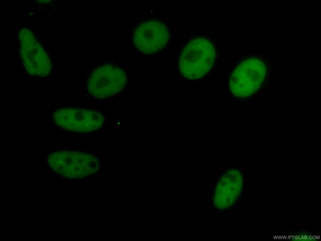 HDAC2 Antibody in Immunocytochemistry (ICC/IF)