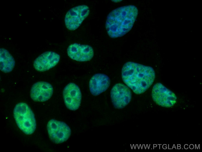 TRIB2 Antibody in Immunocytochemistry (ICC/IF)