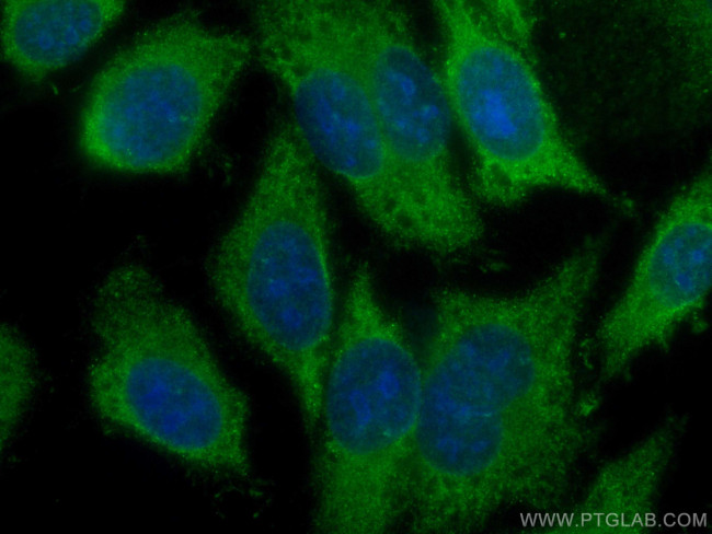 AMPD2 Antibody in Immunocytochemistry (ICC/IF)