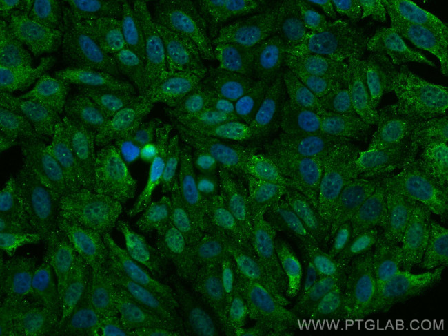 MTH1 Antibody in Immunocytochemistry (ICC/IF)