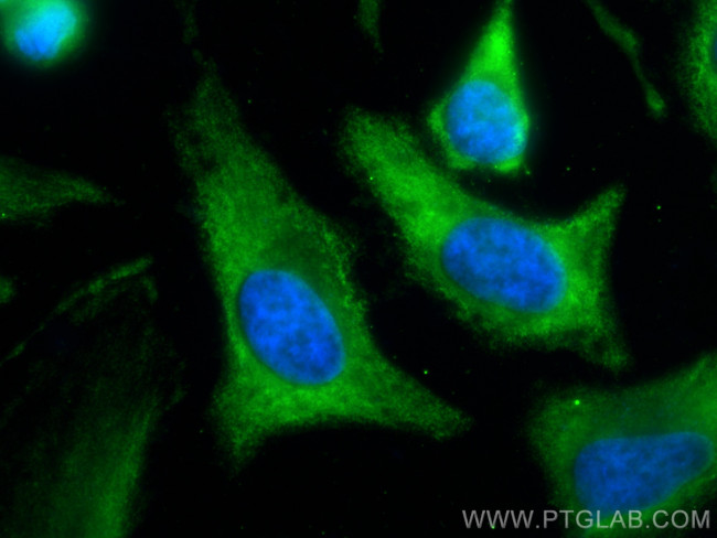 TPI1 Antibody in Immunocytochemistry (ICC/IF)