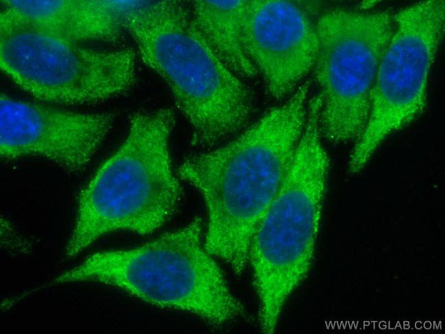 GPT/ALT1 Antibody in Immunocytochemistry (ICC/IF)