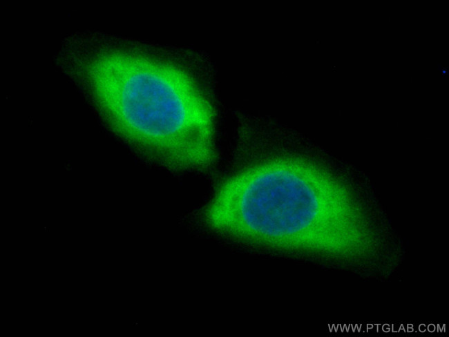 CCT7 Antibody in Immunocytochemistry (ICC/IF)