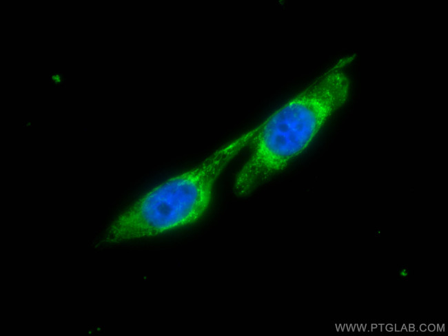 UAP1 Antibody in Immunocytochemistry (ICC/IF)