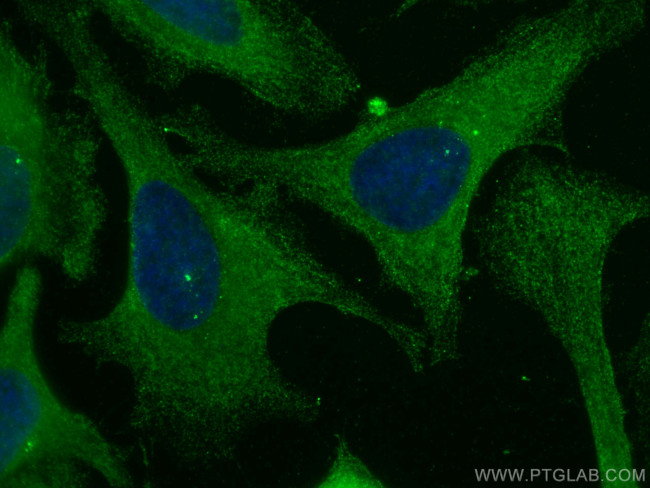 PICALM Antibody in Immunocytochemistry (ICC/IF)