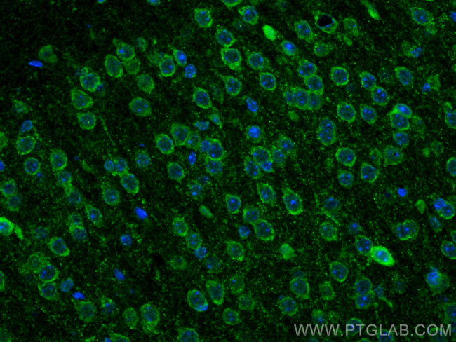 GAD1 Antibody in Immunohistochemistry (PFA fixed) (IHC (PFA))