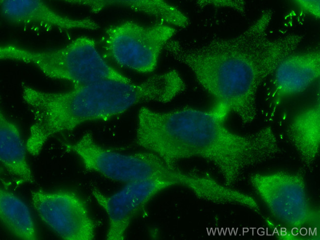 Alix Antibody in Immunocytochemistry (ICC/IF)