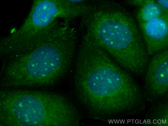 SKP1 Antibody in Immunocytochemistry (ICC/IF)