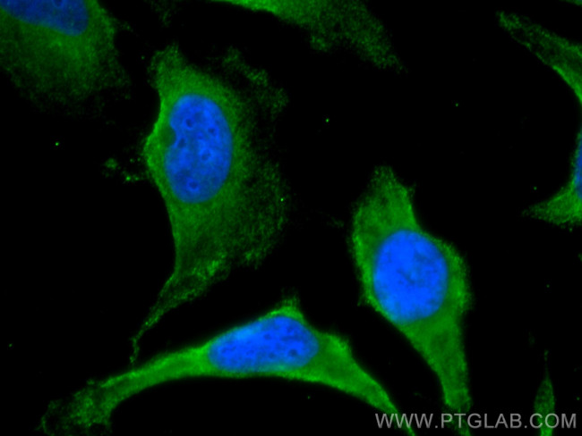 PRKAR2A Antibody in Immunocytochemistry (ICC/IF)