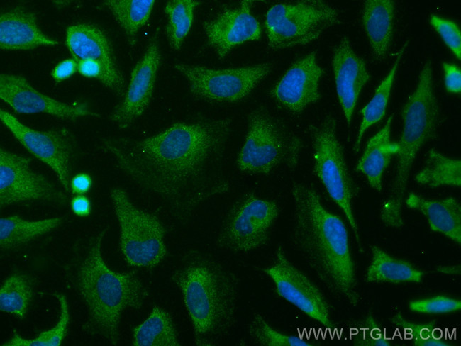 BAD Antibody in Immunocytochemistry (ICC/IF)