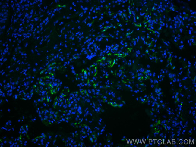 THBD Antibody in Immunohistochemistry (PFA fixed) (IHC (PFA))