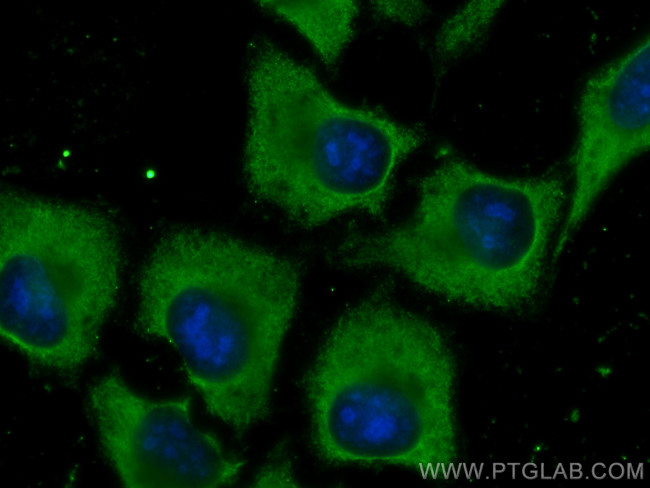 GEMIN8 Antibody in Immunocytochemistry (ICC/IF)