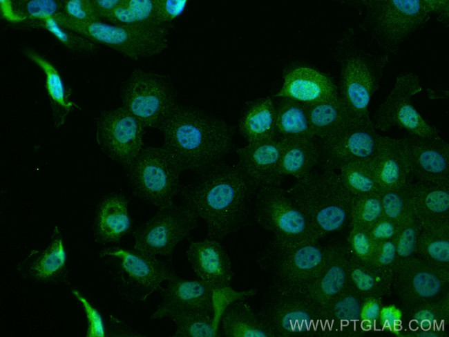 MEK1 Antibody in Immunocytochemistry (ICC/IF)