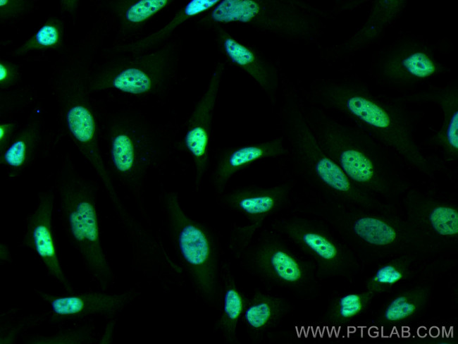 FKBP5 Antibody in Immunocytochemistry (ICC/IF)