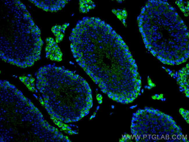 SLC36A3 Antibody in Immunohistochemistry (PFA fixed) (IHC (PFA))