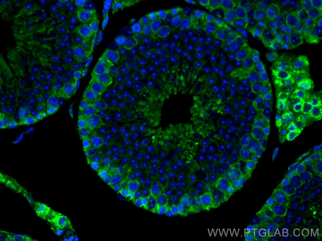 SLC36A3 Antibody in Immunohistochemistry (PFA fixed) (IHC (PFA))