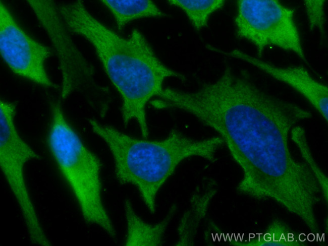 GART Antibody in Immunocytochemistry (ICC/IF)