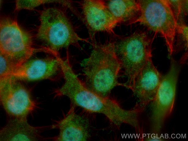 PARG Antibody in Immunocytochemistry (ICC/IF)