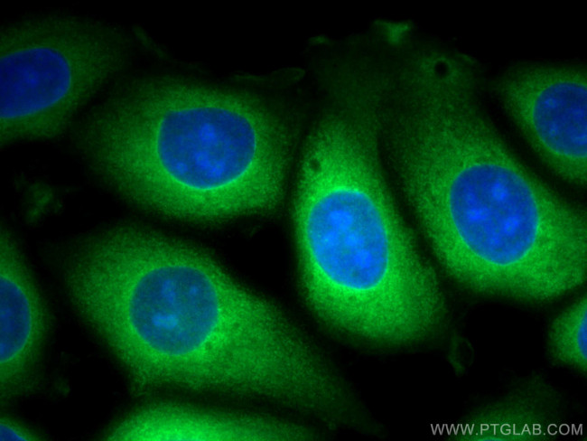 TrpRS Antibody in Immunocytochemistry (ICC/IF)