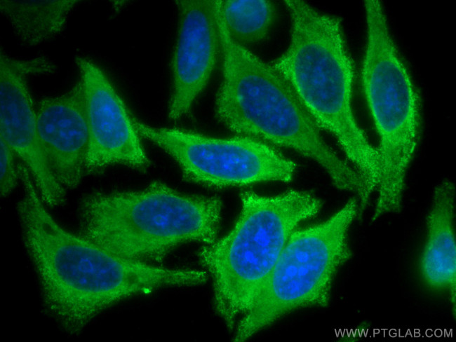 FAH Antibody in Immunocytochemistry (ICC/IF)