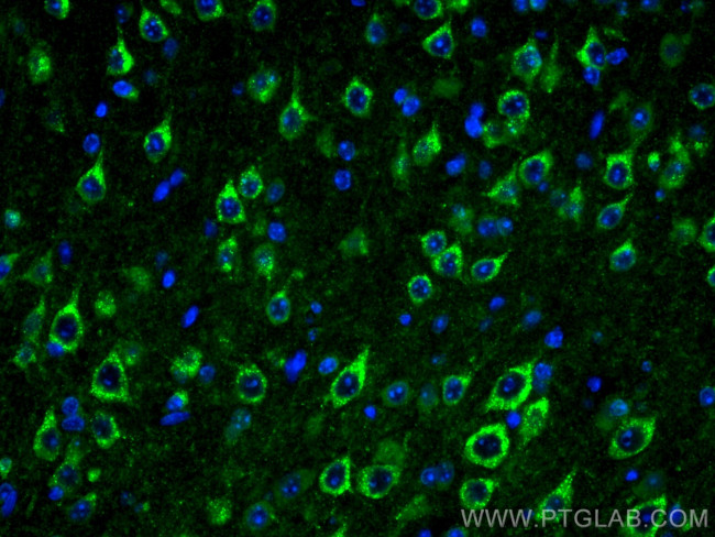 Sortilin Antibody in Immunohistochemistry (PFA fixed) (IHC (PFA))