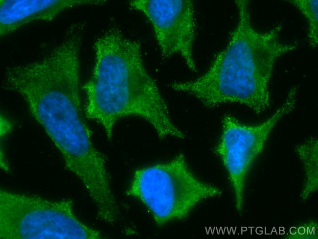 RAB9B Antibody in Immunocytochemistry (ICC/IF)