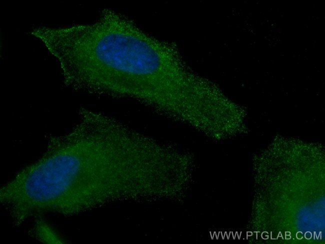 TBC1D4 Antibody in Immunocytochemistry (ICC/IF)